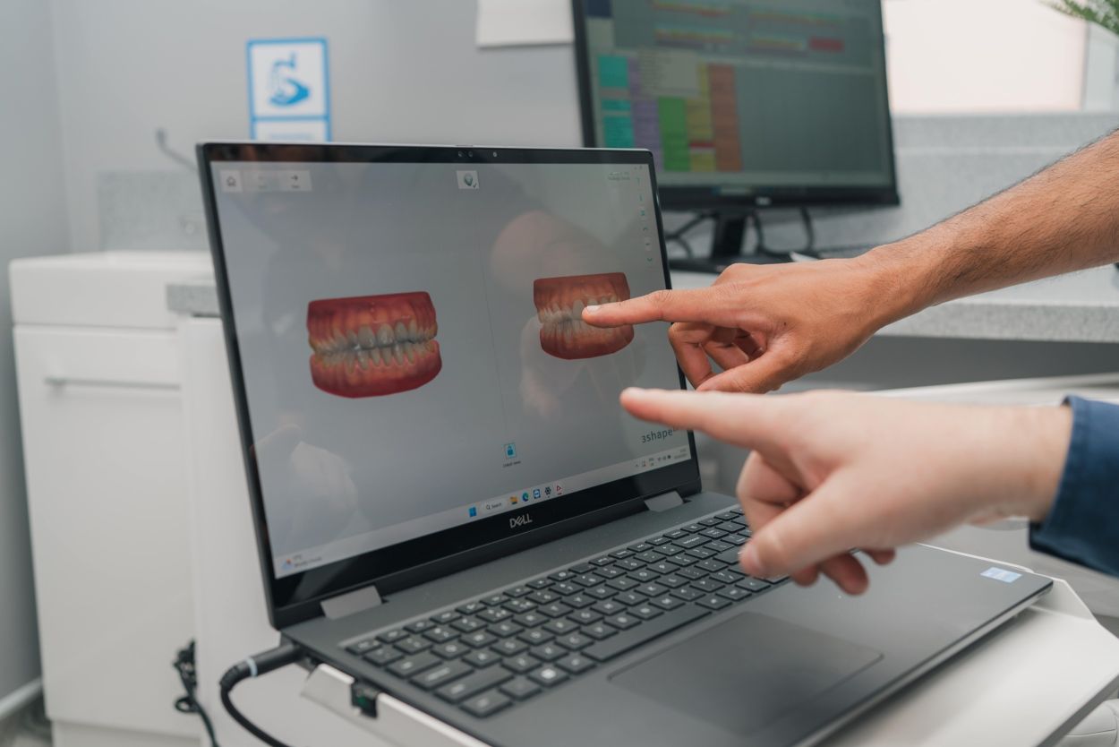 3D digital dental scanner