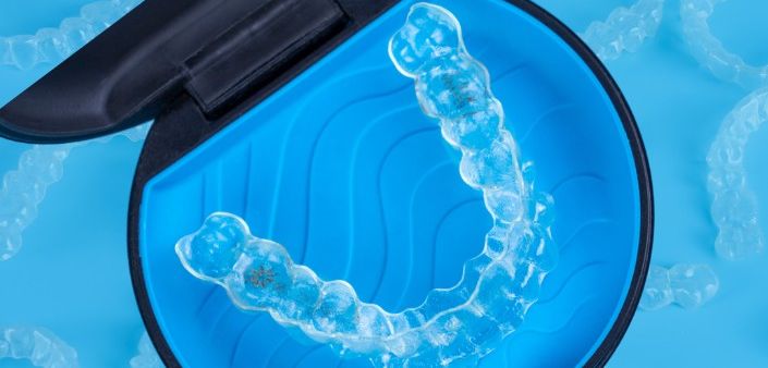 Teeth straightening, made simple