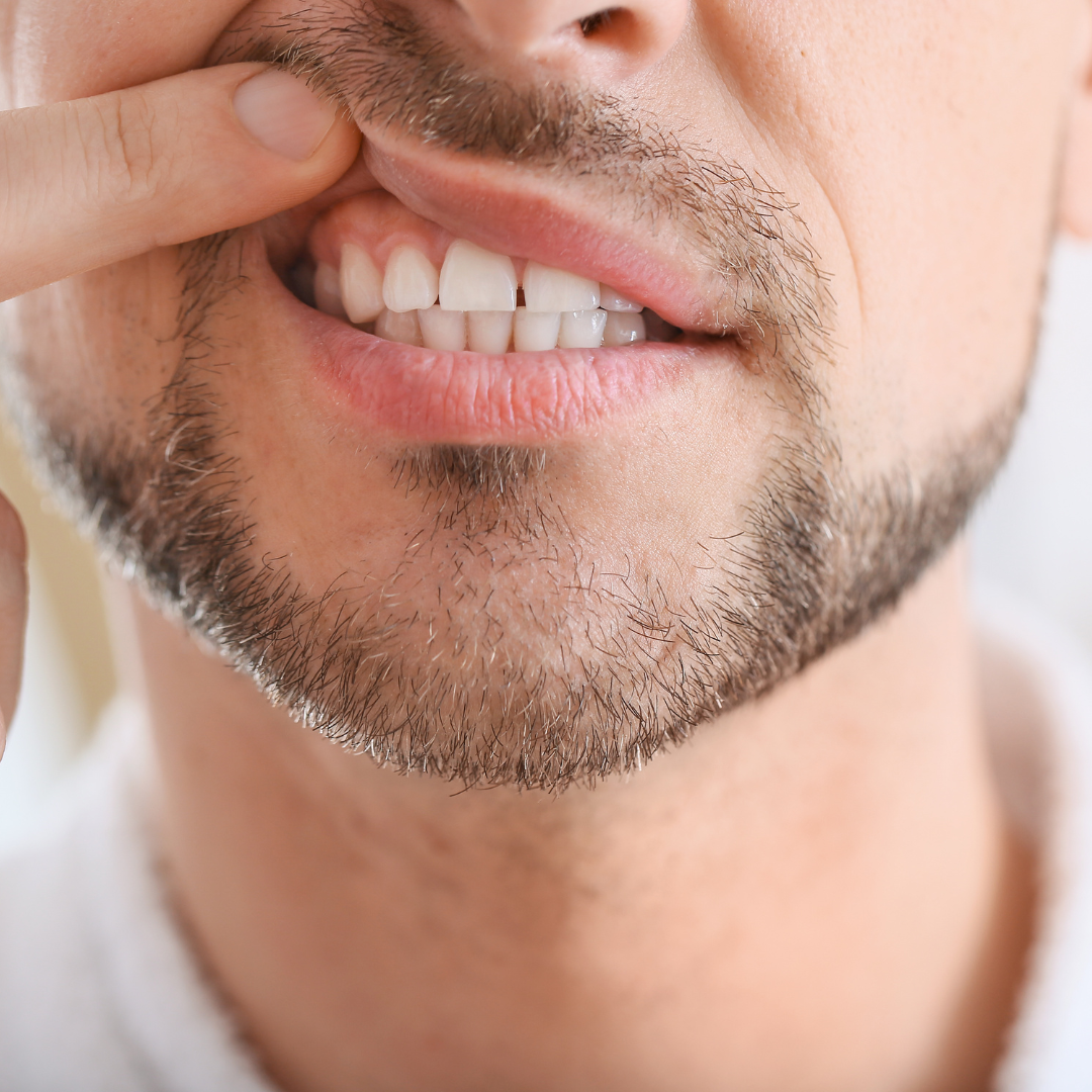 Gum-disease